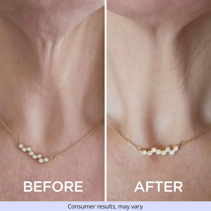 Tighten & Lift Neck Cream | REVOSKIN